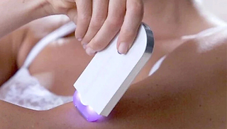 Sensor Light Hair Remover - Face, Legs, Arms and More!