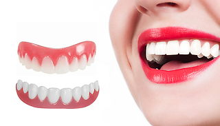 SmileShine Instant Veneers