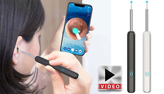 WiFi-Enabled Visible Ear Wax Removal Kit